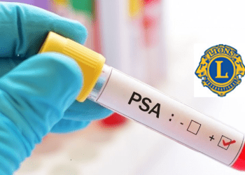Free prostate cancer testing event this month