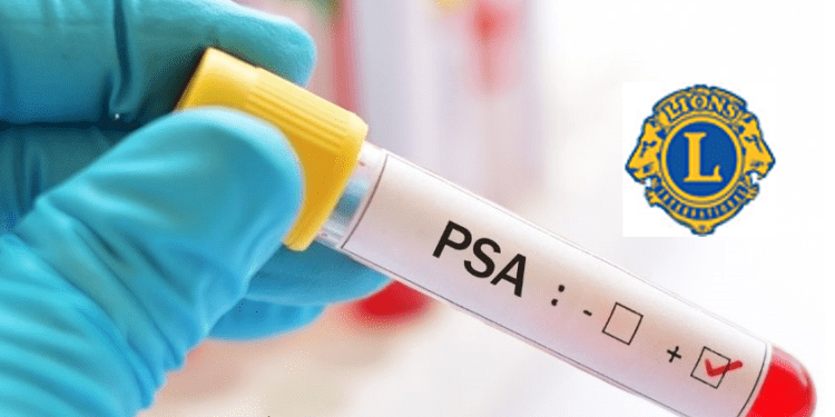 Free prostate cancer testing event this month